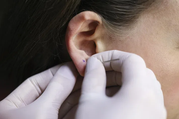 Young woman puncturing her ear. Unrecognizable Caucasian female.
