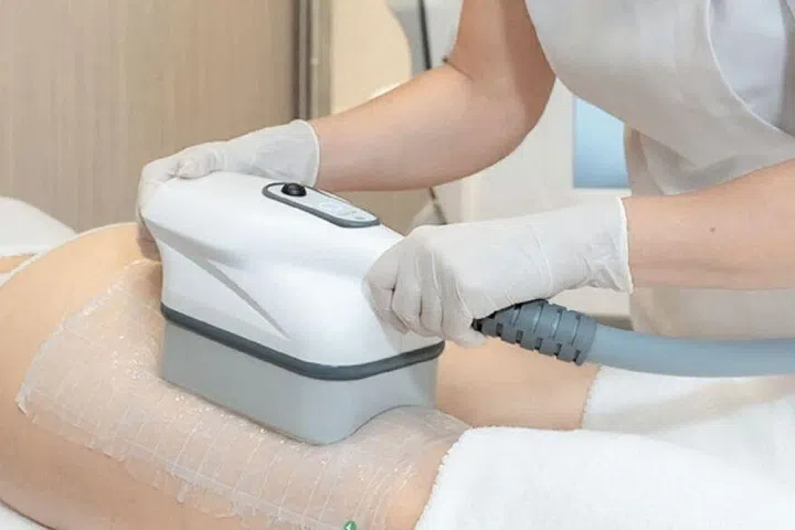 In a Cooltech Define session, controlled cooling works on targeted areas while the patient relaxes.