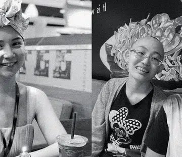 Breast Cancer young survivors singapore