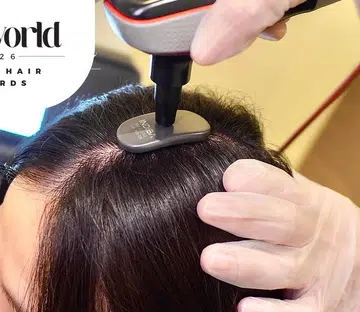 Best Scalp Reset Treatment Svenson INDIBA SV Hair Regain