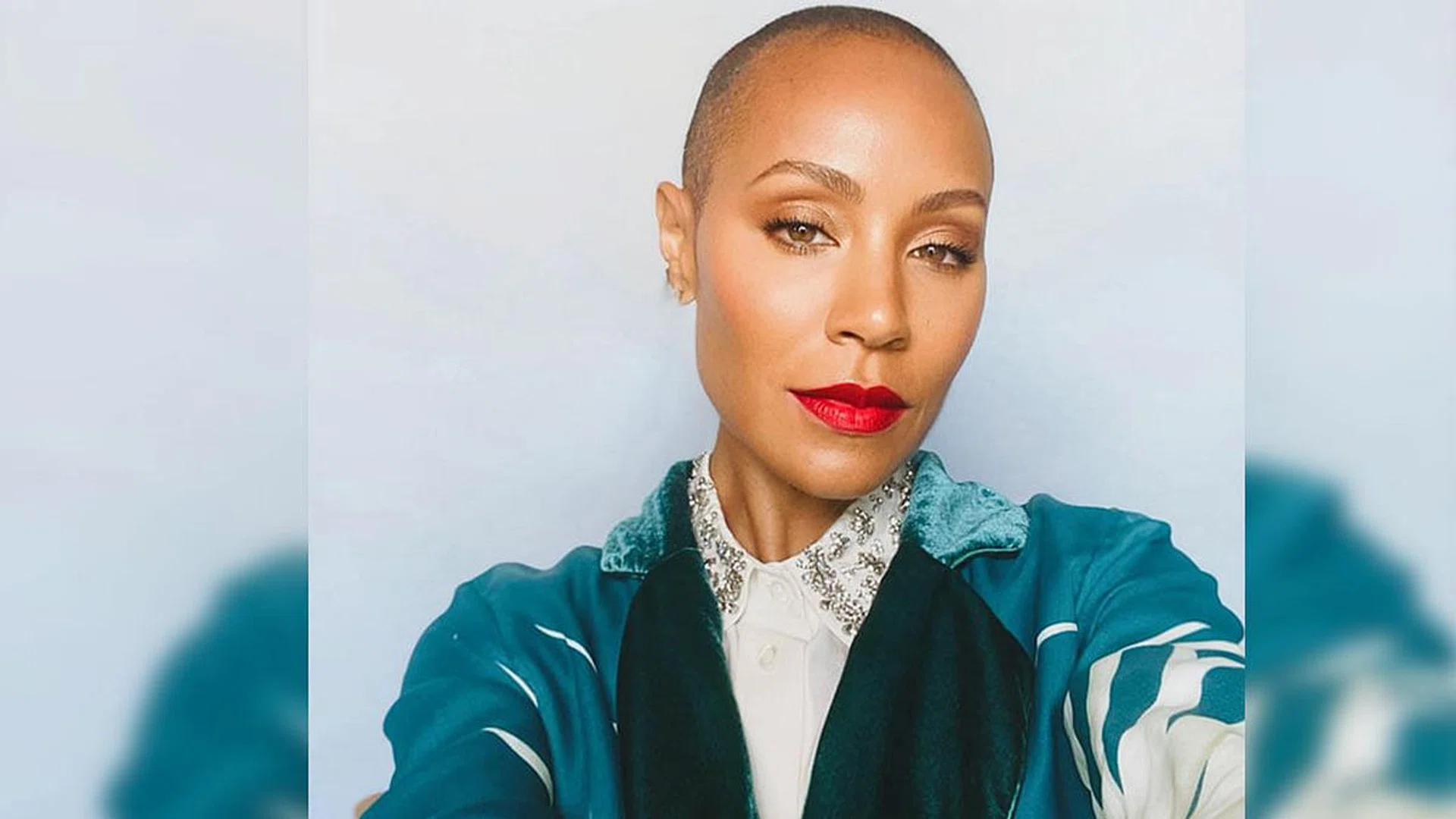 What is alopecia areata really?