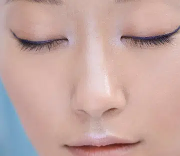 are large pores genetic - how to make pores smaller - singapore - thumb