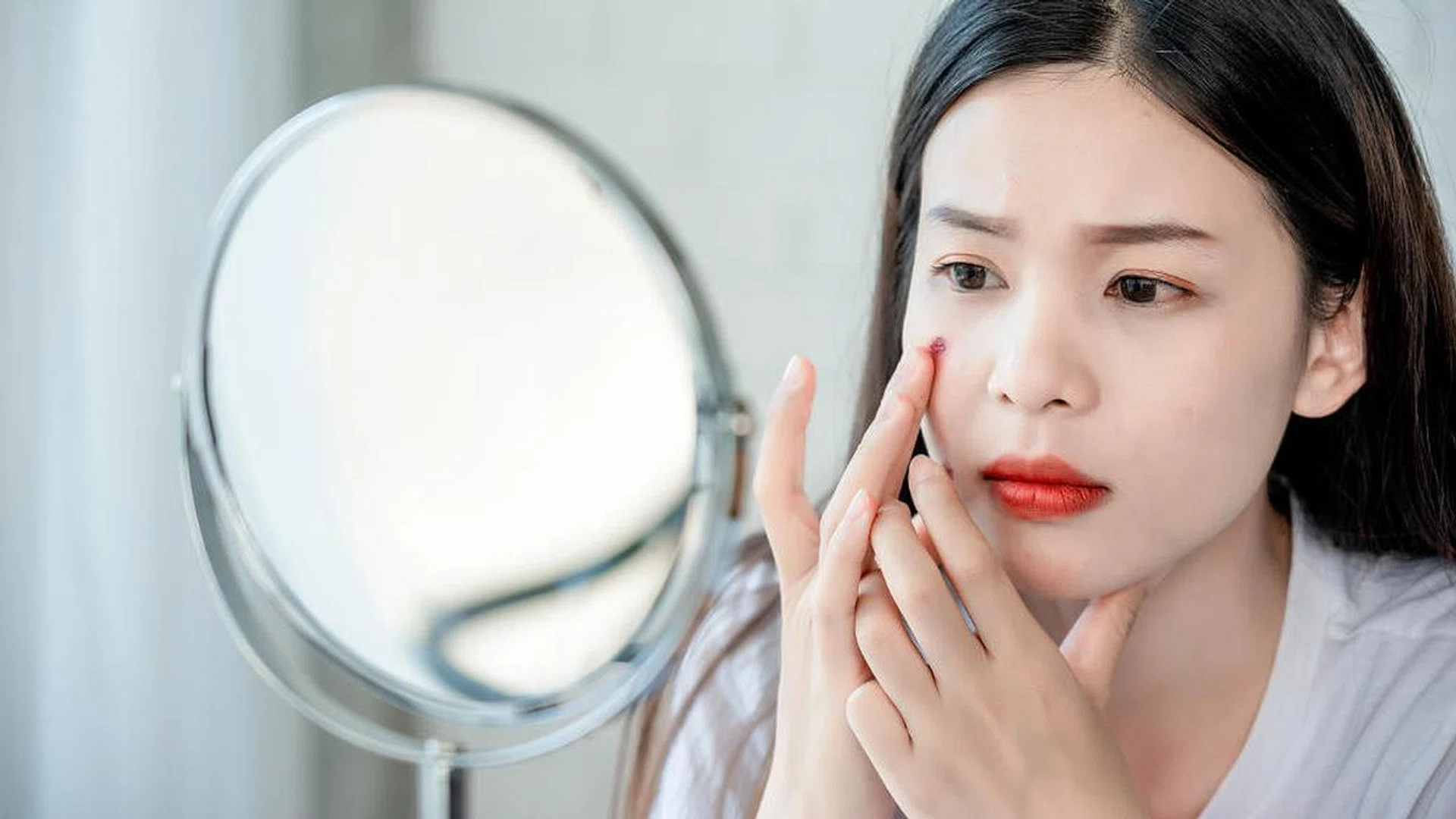 Ask a derm: My pimple won't surface. How ah?