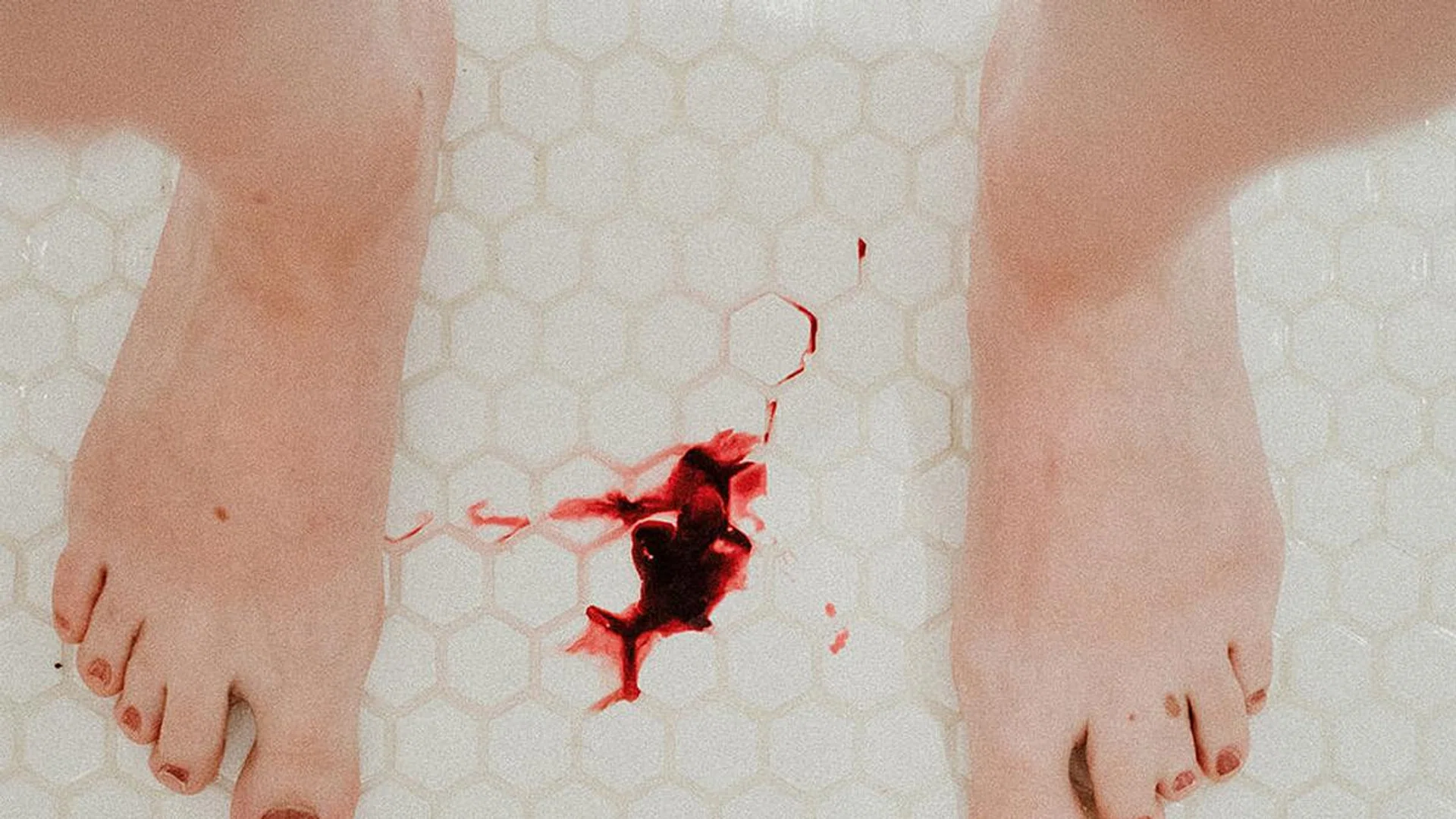 Unsplash