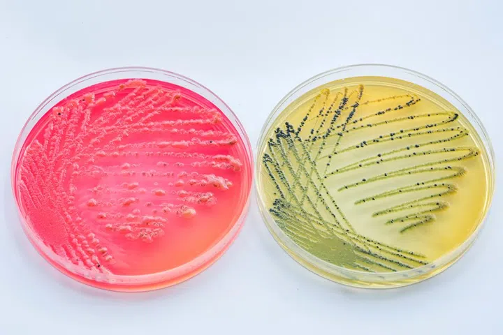 Colored Petri dishes with bacterial colonies on a white background.