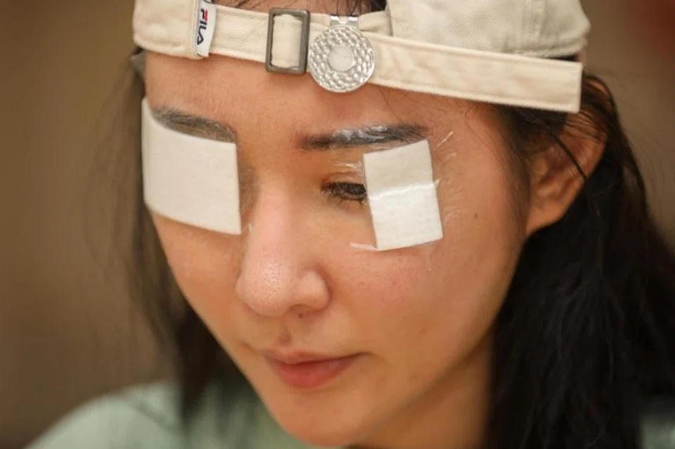 Aden, 32, suffered formaldehyde-induced conjunctivitis and wound infection of the eye after renovating her apartment.