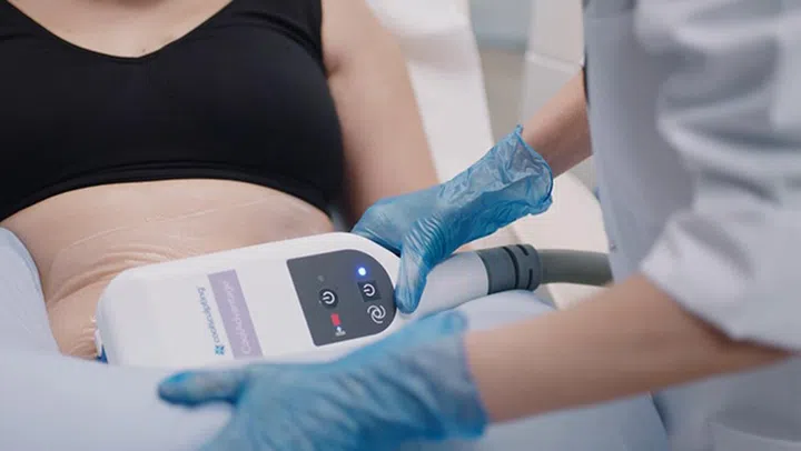 Allergan-Aesthetics-CoolSculping