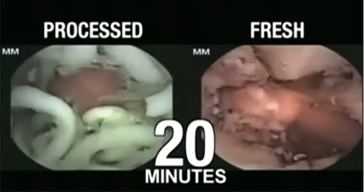  左图为快熟面，右图为一般面条。（视频截图） 