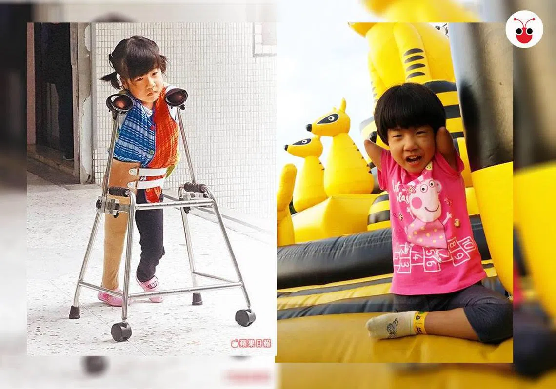 年仅五岁的徐又立在不完美中找到自信与微笑。（苏羽葳制图）