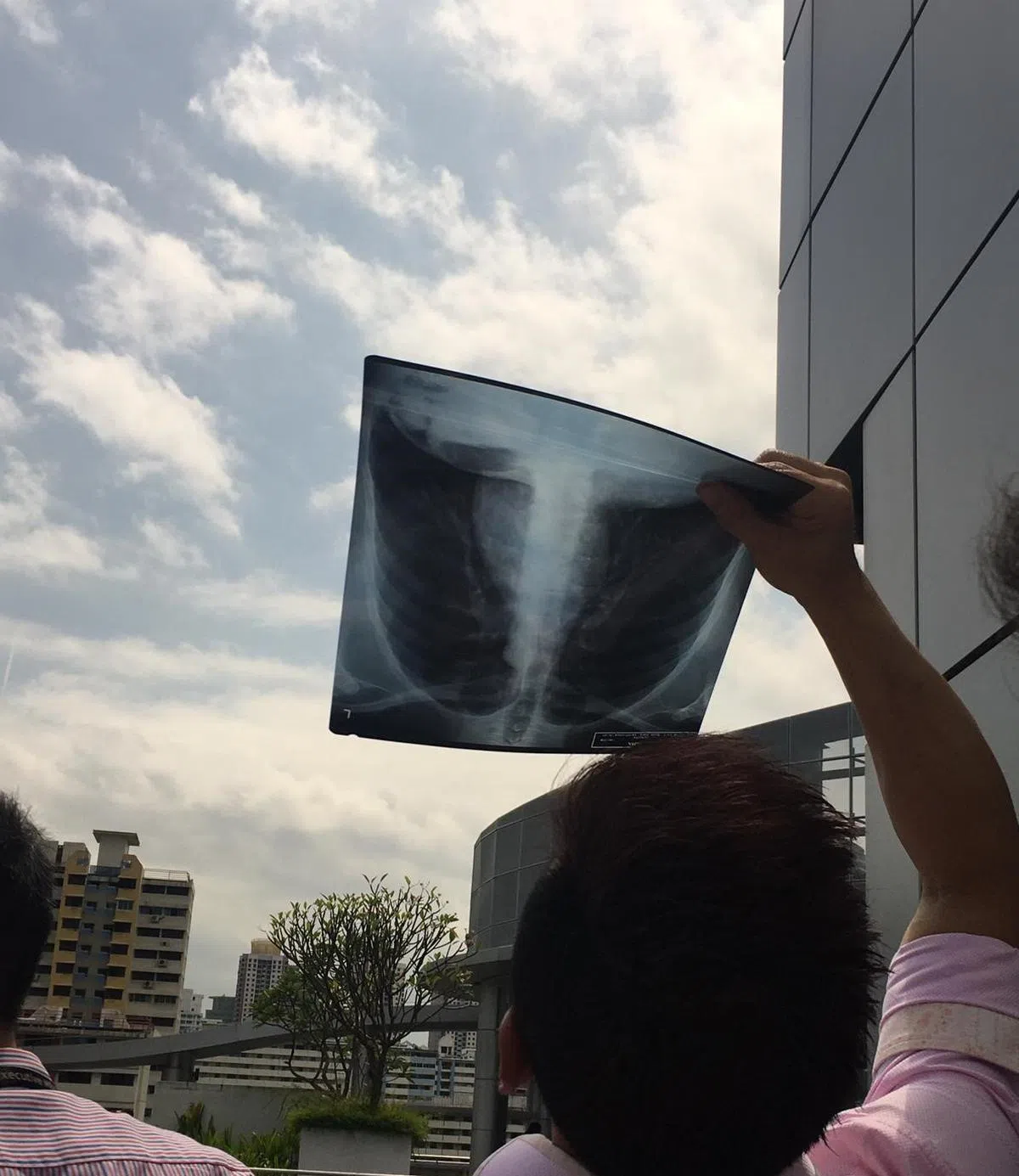  这个肺看起来还挺健康，怪不得可以拿出来秀。（红蚂蚁摄） 