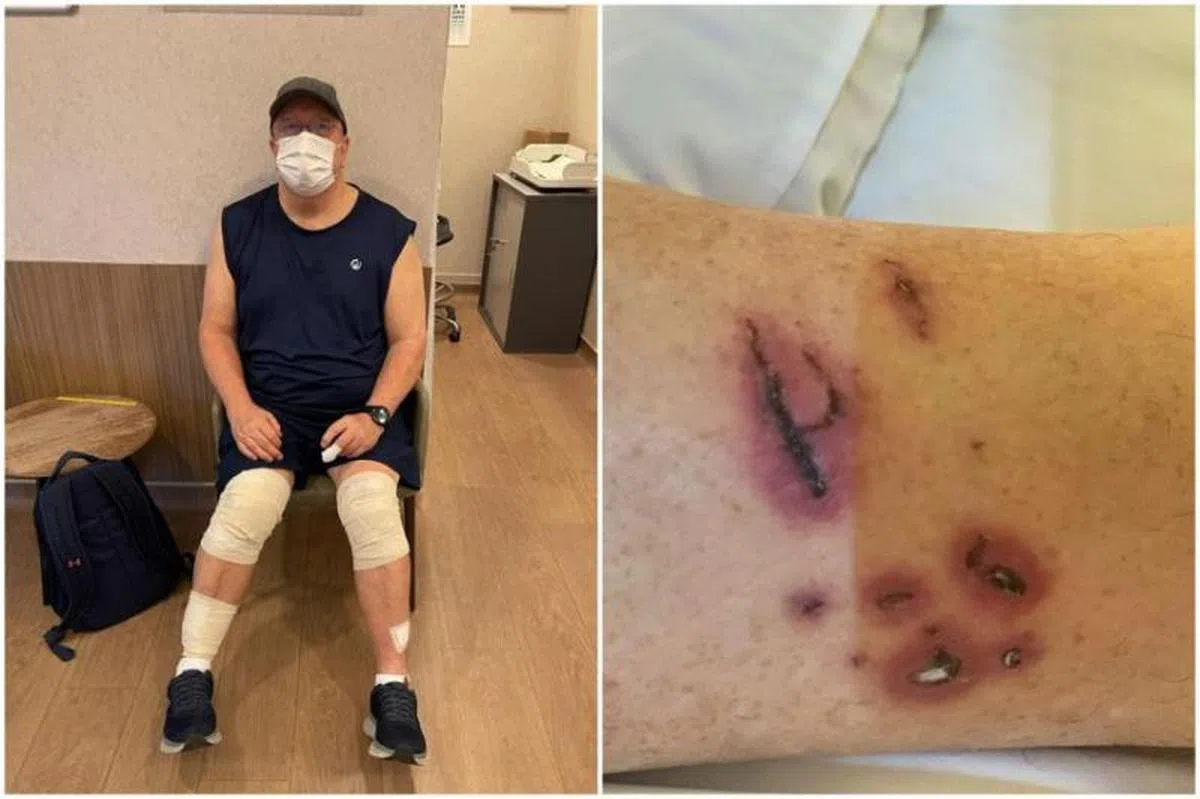 医生检查后告知斯宾塞，他的身上共有26处伤口，其中14个在臀部，8个在脚踝，另外4个在膝盖。（Graham George Spencer）