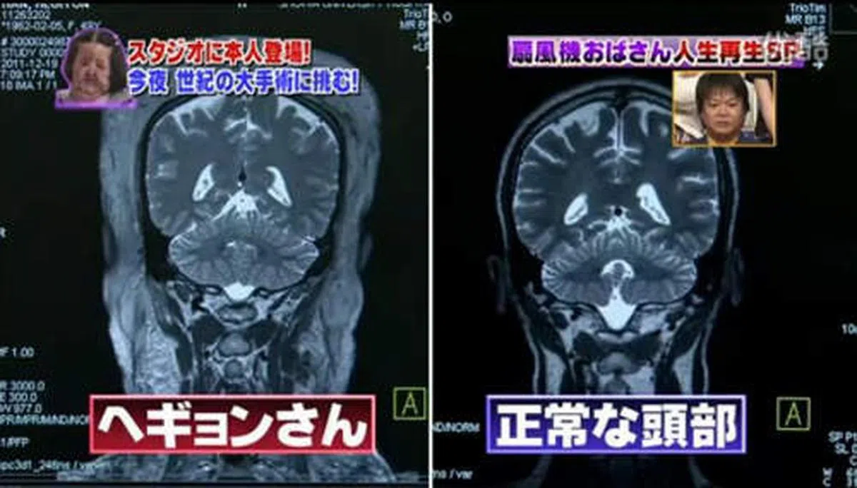  （视频截图） 