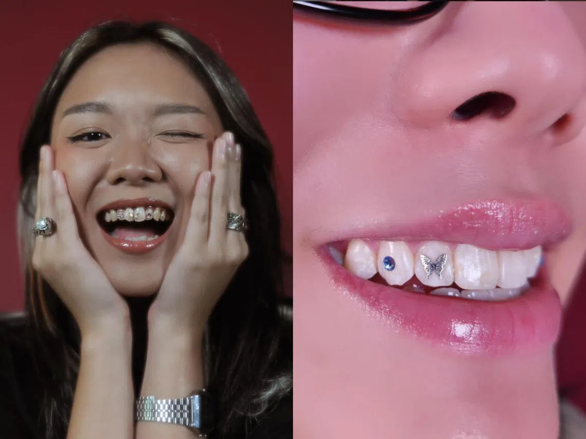 有各种图案的牙饰供挑选，如爱心、花瓣、樱桃、蝴蝶等。(Instagram@thirdeye.toothgems.sg)