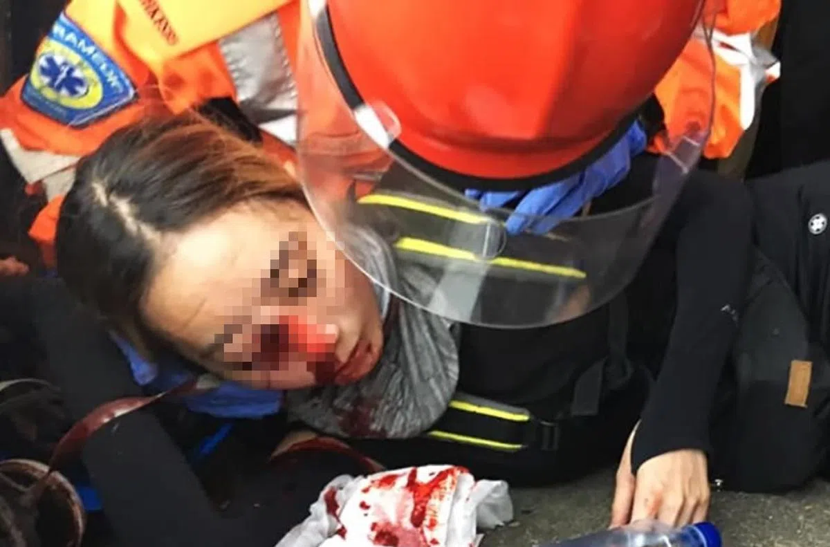  一名女示威者早前在抗争活动中疑似被警方布袋弹击中右眼。（Socrec 社会记录频道） 