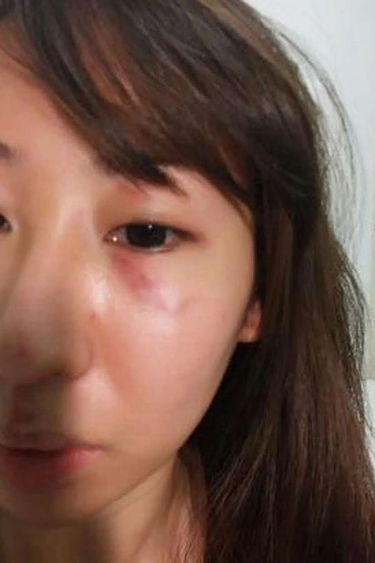  Rachel第一次被打。（Rachel博客） 