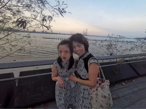 郭秋华（右）与28岁的特需女儿洪敏。（郭秋华提供）