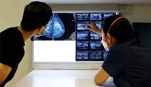 更多50岁以上的青壮年，如今也被癌症“盯上”。（联合早报）