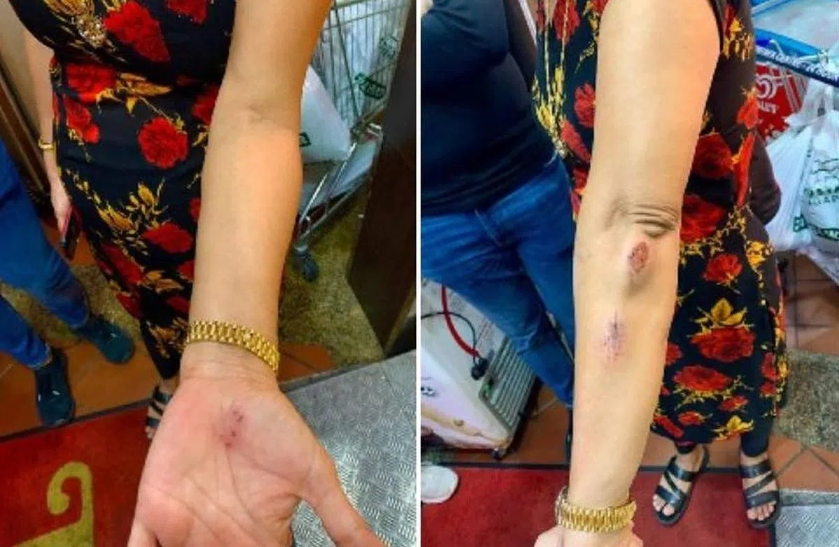  一名印族妇女5月7日在晨运时将口罩拉下，被一名路过的男子连番呵斥，还用脚将她踢倒在地，导致她重重摔倒受伤。（Parveen Kaur） 