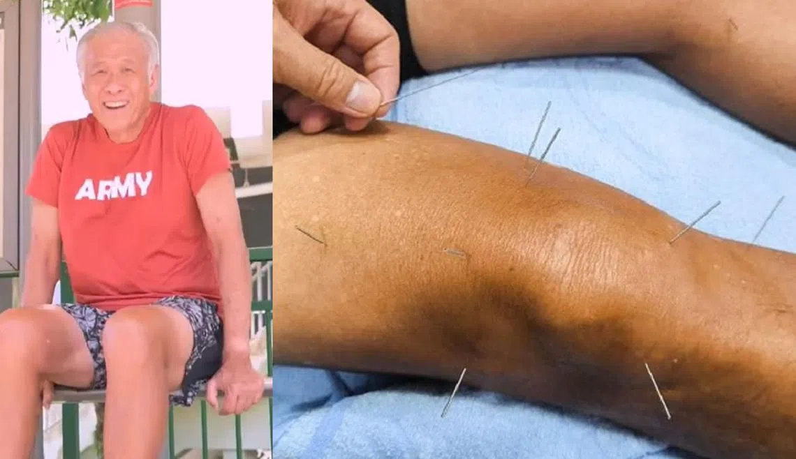 国防部长黄永宏日前在北京第一次接受针灸。（取自黄永宏脸书／红蚂蚁制图）