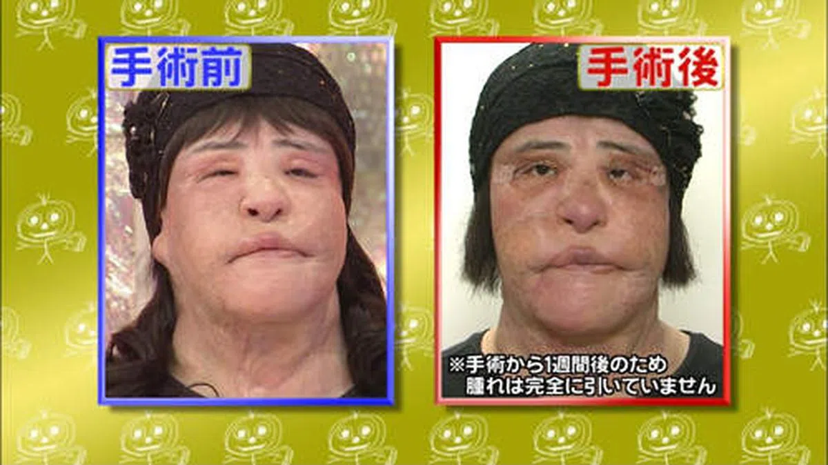  （视频截图） 
