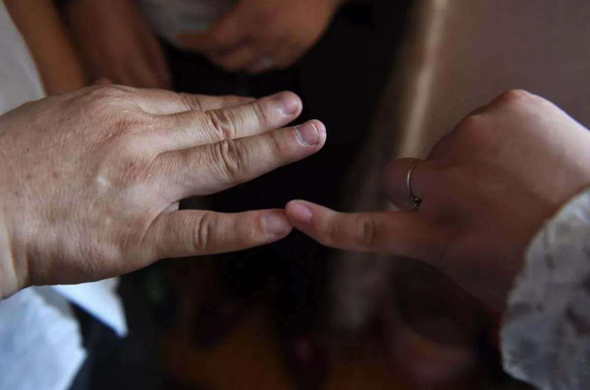  王明清与女儿康英的小指，均有不同程度的向内弯曲。 （互联网） 