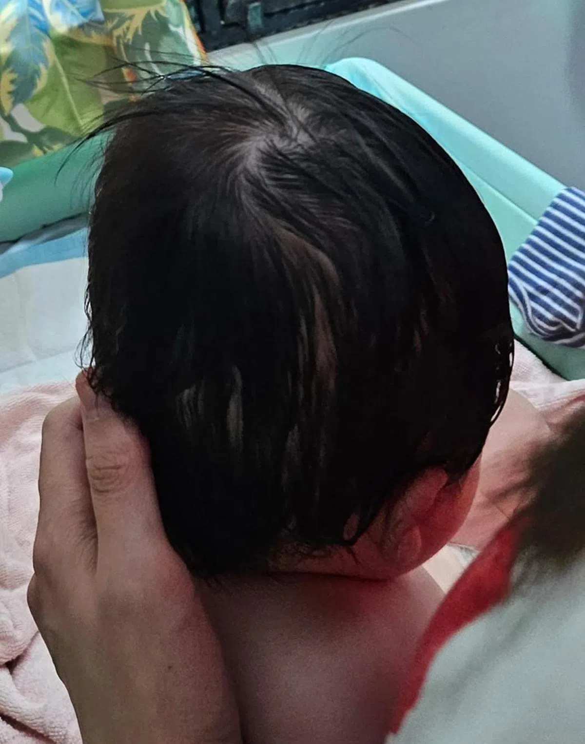 在女宝宝三个月大时，被诊断轻微短头畸形，但不影响发育。（蚁粉提供）