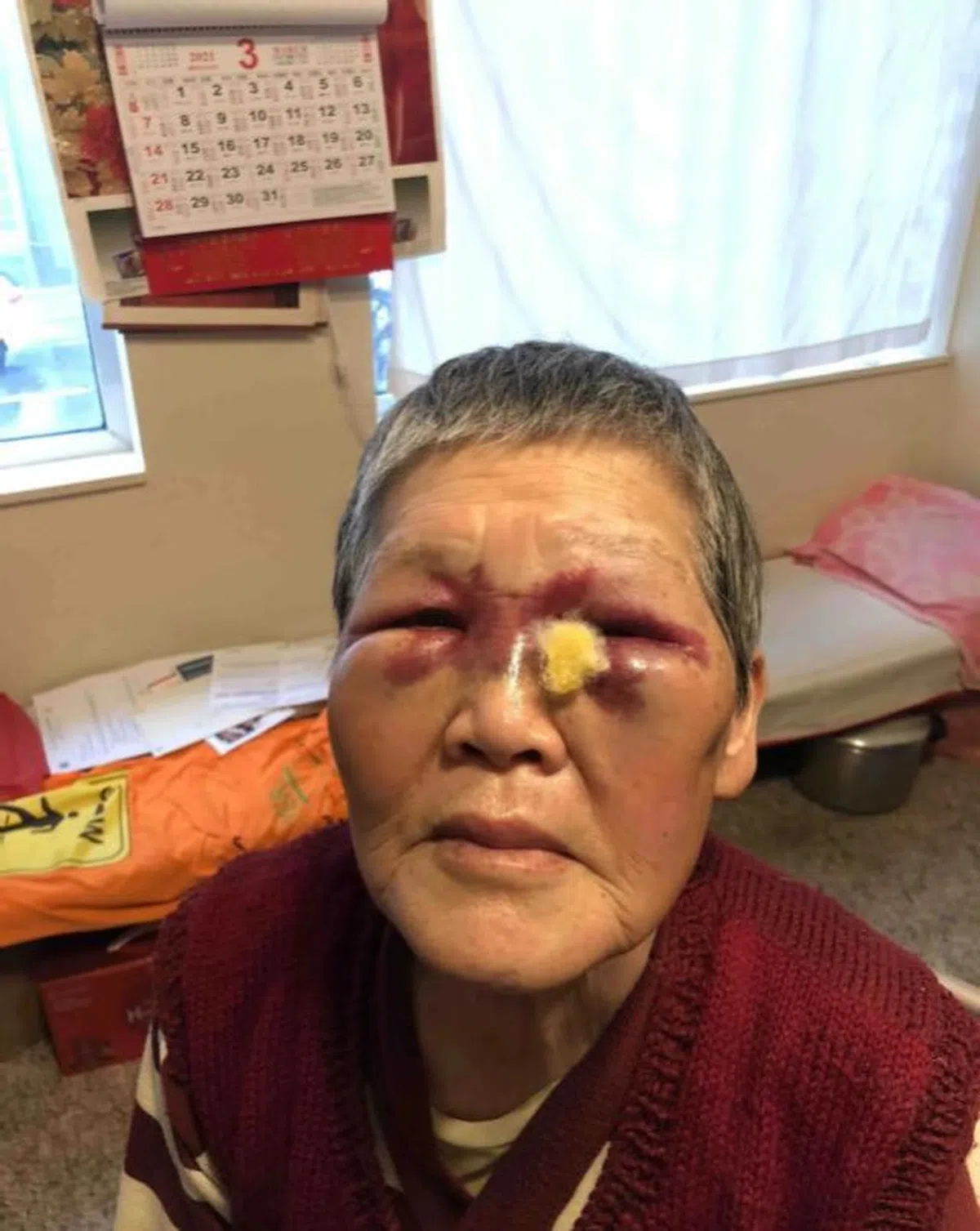  谢奶奶不仅身体受到了伤害，心灵上也受到严重创伤。（互联网） 