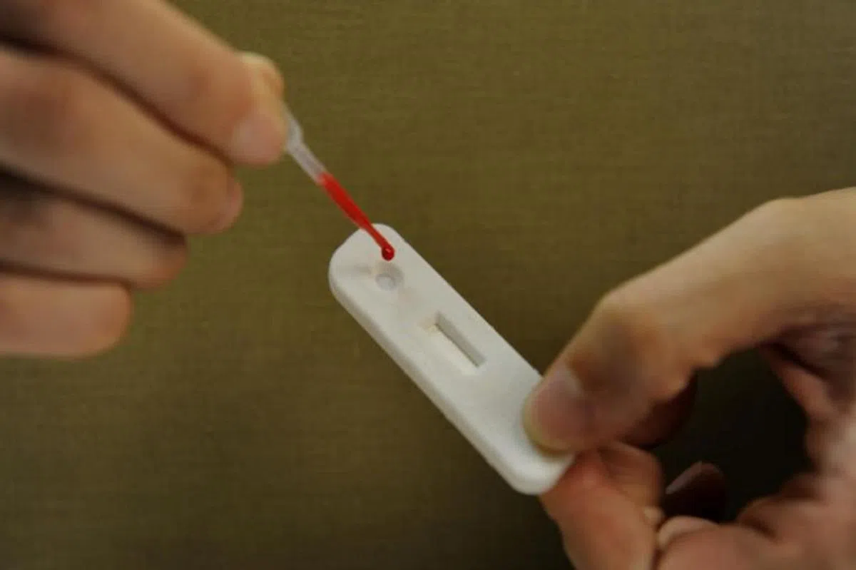  在新加坡的传染病法令下，凡确诊的HIV带原者都必须向卫生部注册，个人机密资料将会存放在HIV资料库，便于卫生部监控本地的传播情况，追踪感染源头，以及评估疾病预防与管理措施等。（海峡时报） 