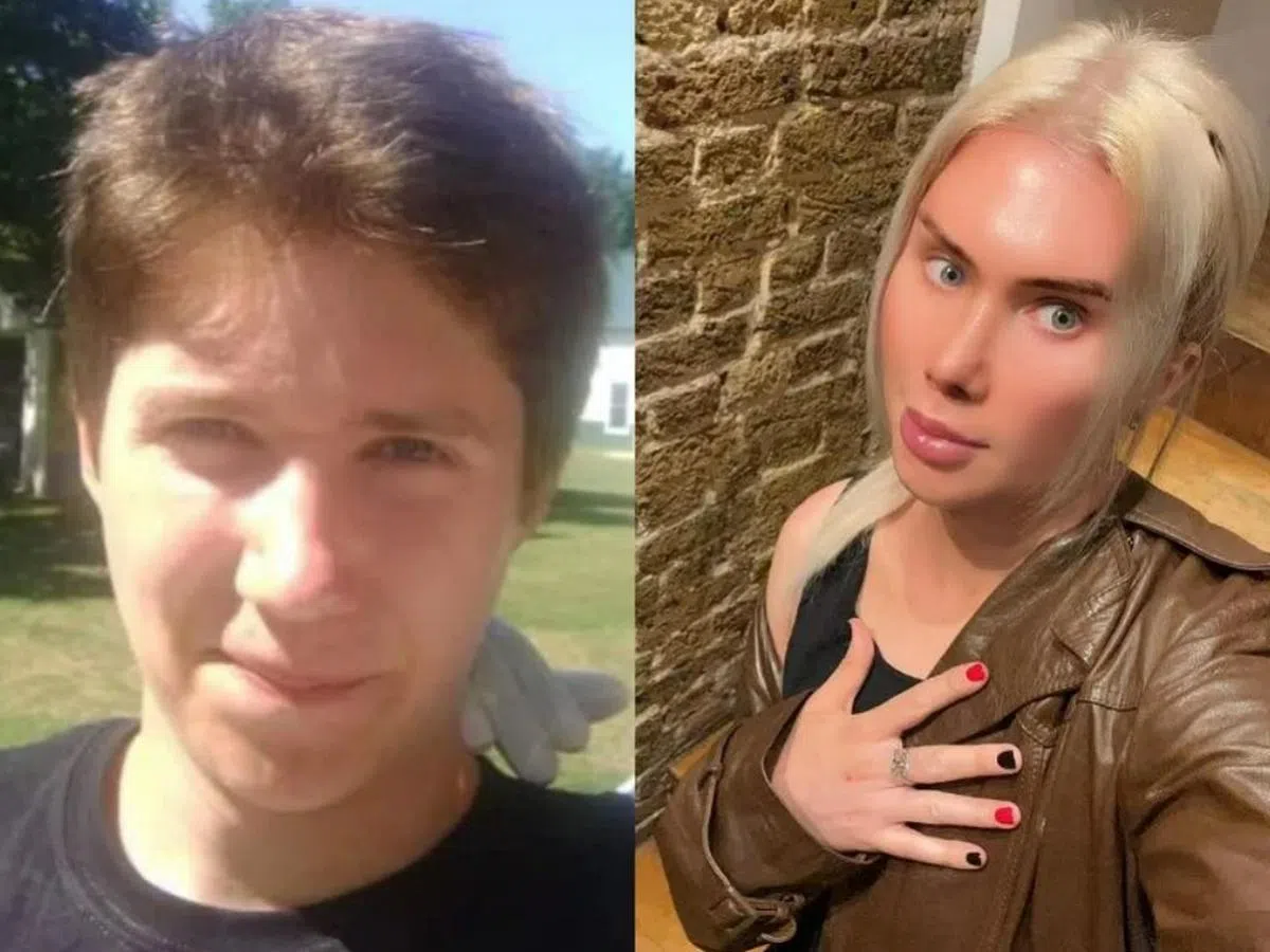 朗登整形前（左）和整形后（右）也差太多了吧？（互联网）