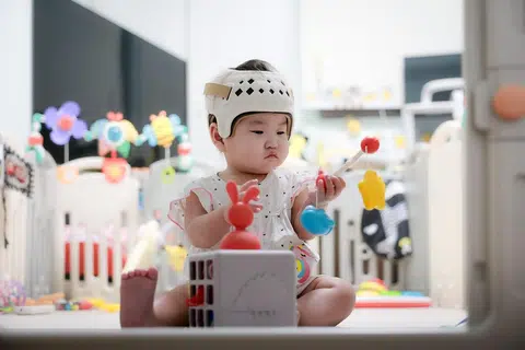 现年13个月大的女宝宝黄佩萱已经佩戴头盔矫正头型7个月了。（竹脚妇幼医院)