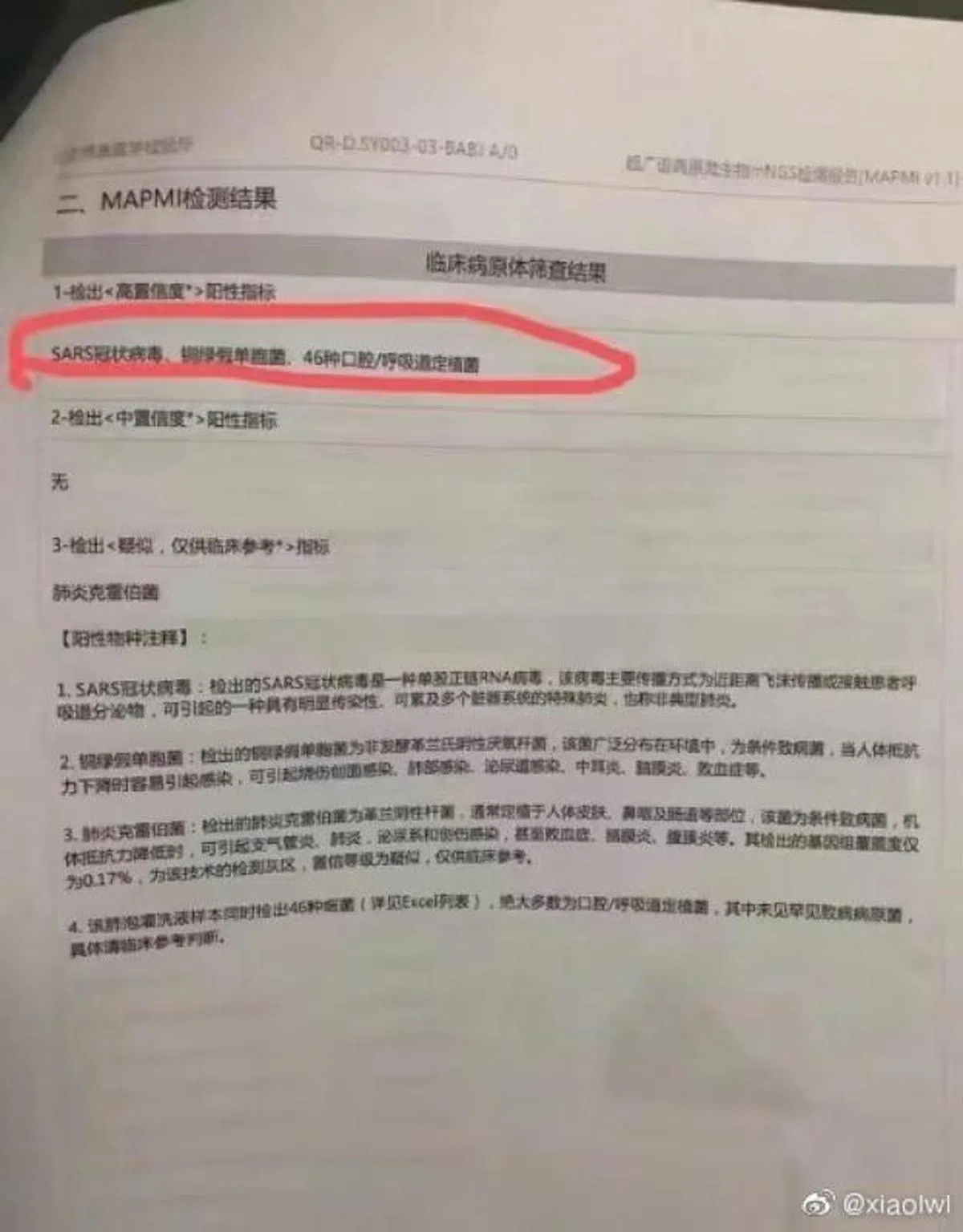  检测报告显示病人具有同SARS冠状病毒高度相似的指标。（李文亮微博 