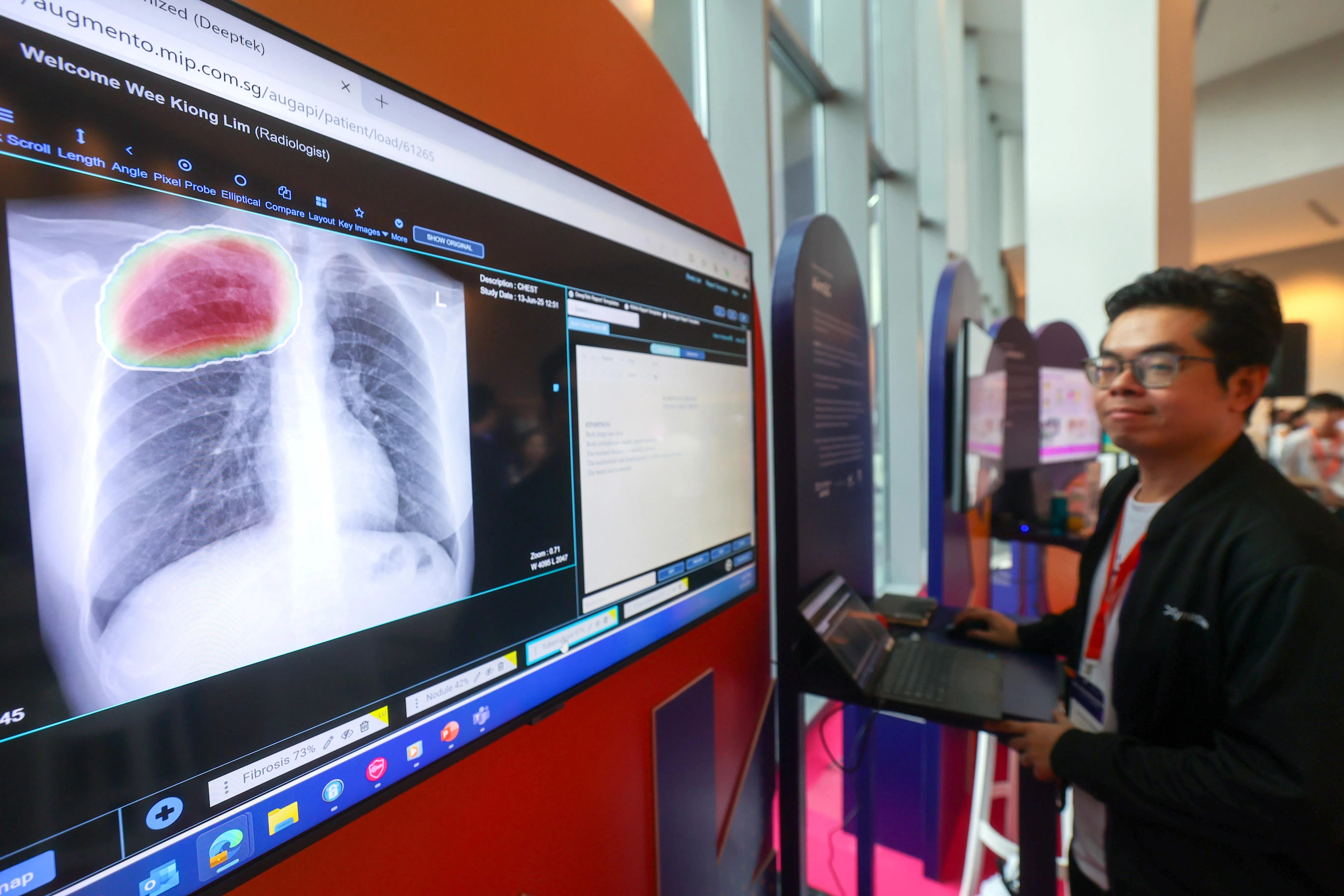 本地公立医疗系统自2023年采用人工智能医疗影像诊断系统AimSG，为胸部和乳房X光，以及甲状腺超声波等影像检查提供人工智能模型，以及结核病和骨折检测。该系统从2025年6月起在国家传染病中心和兀兰医疗园采用。