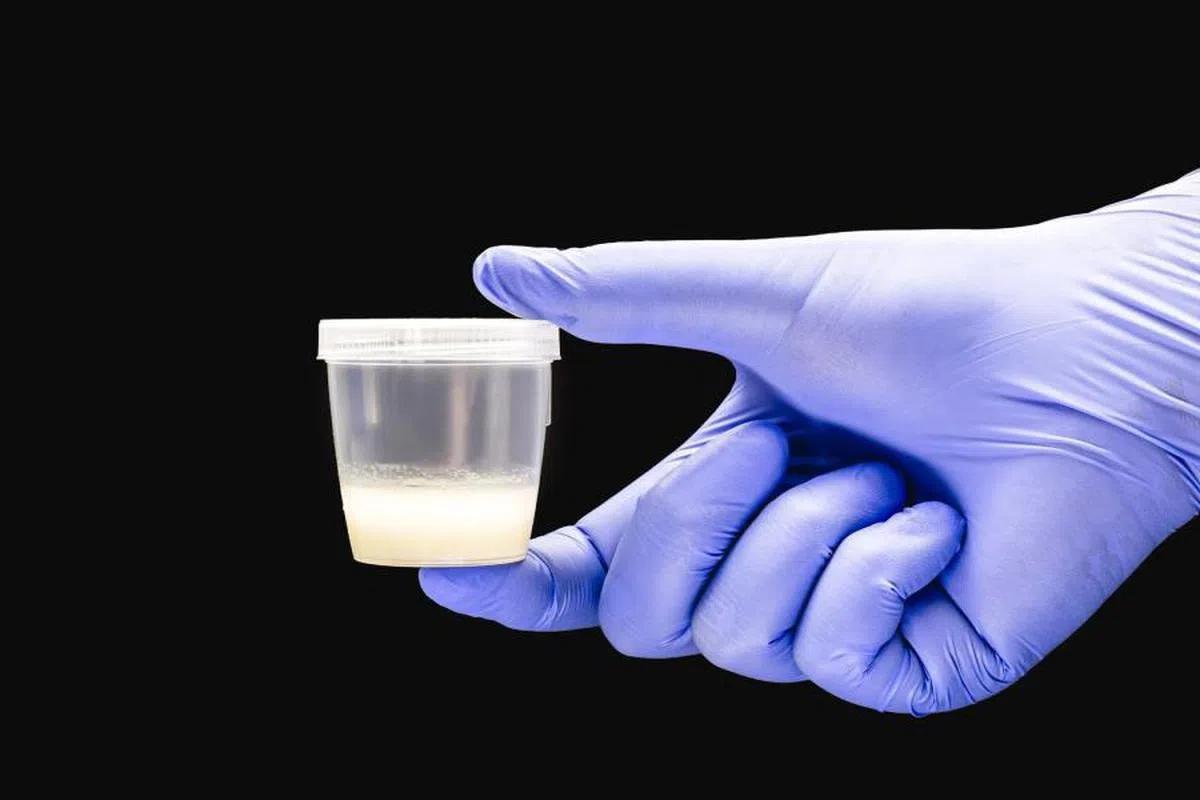 研究显示，全球男性精子品质呈下滑趋势。（互联网示意图）