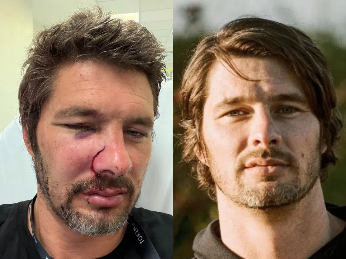 Nathanael Geier称在新加坡被打枪。原本帅气的脸孔（右）肿成如左图所示。