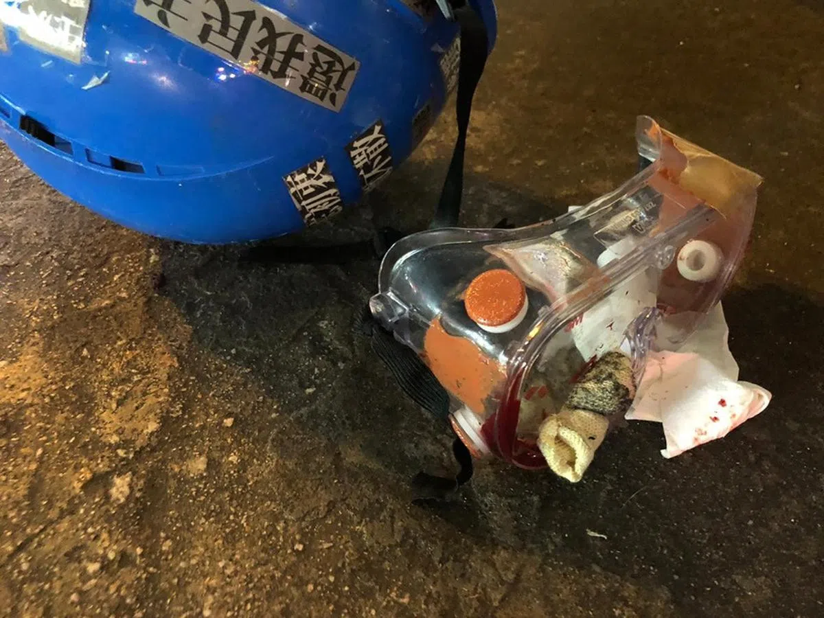  疑似布袋弹的物体黏着在受伤女子佩戴的眼罩上。（Socrec 社会记录频道） 