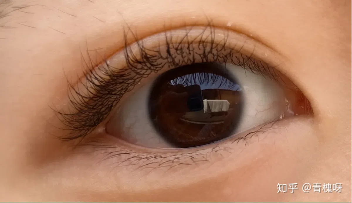 令人又爱又恨的双睫症。（互联网）