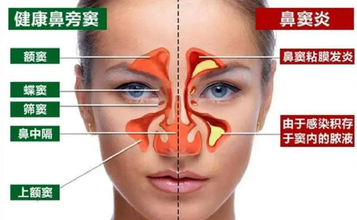 （健康医疗网制图）