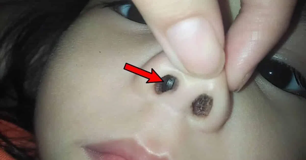 一些幼童喜欢把东西放入鼻子，因为他们的嗅觉比触觉更灵敏。（互联网）