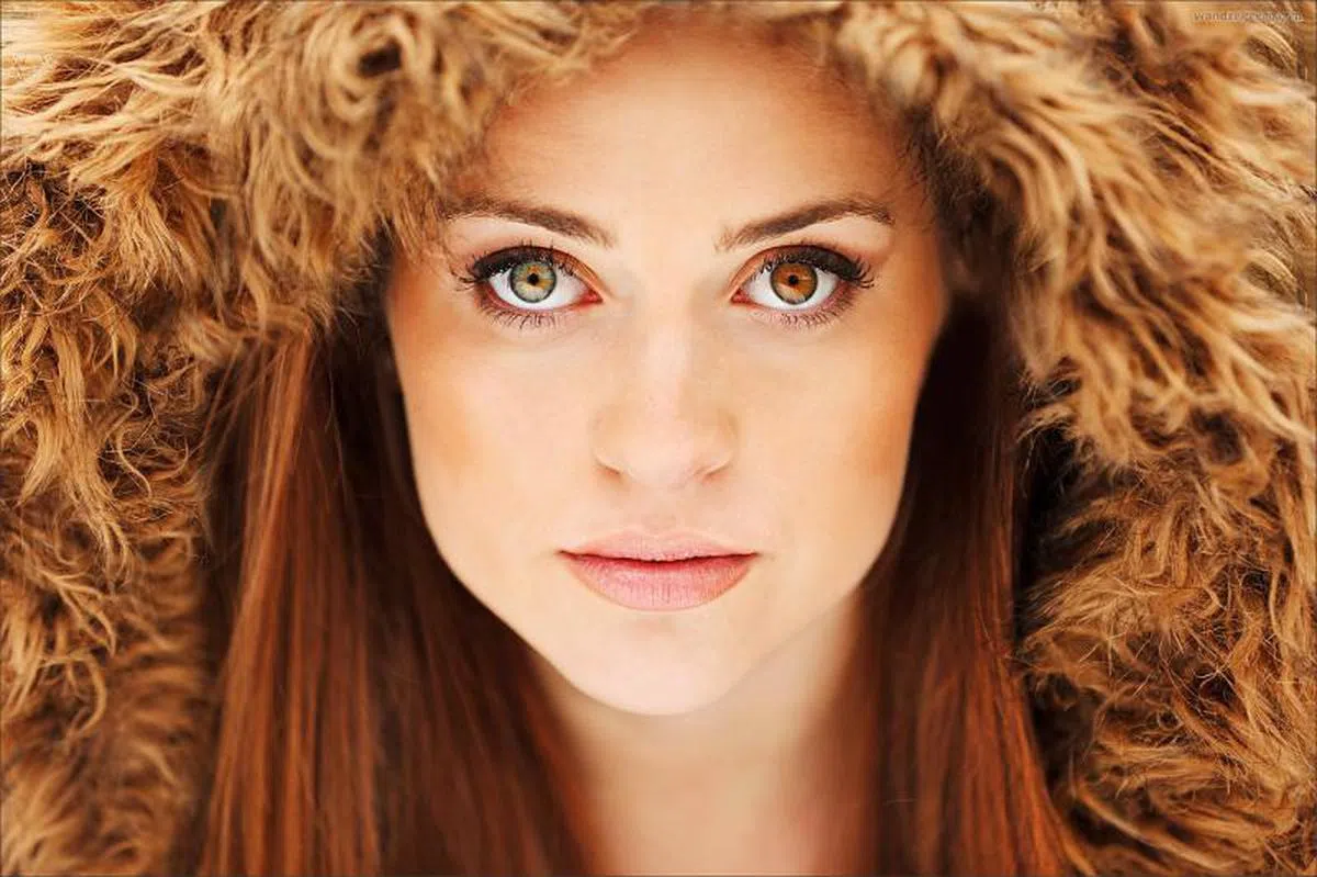 这位模特儿的两只眼珠的颜色不一，并不是戴了不同颜色的隐形眼镜，而是她患有异色症。（纽约时报）