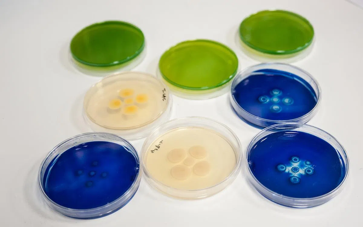 不当使用或过量服用抗生素，可能导致细菌变异成“超级细菌”。图为西班牙实验室培植的“超级细菌”。（CSIC西班牙国家研究理事会）