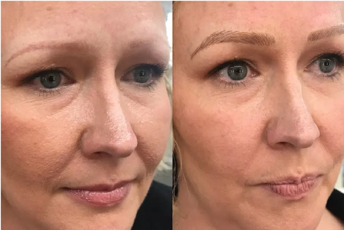 纹眉、纹眼线后的前后对比。（Handout）