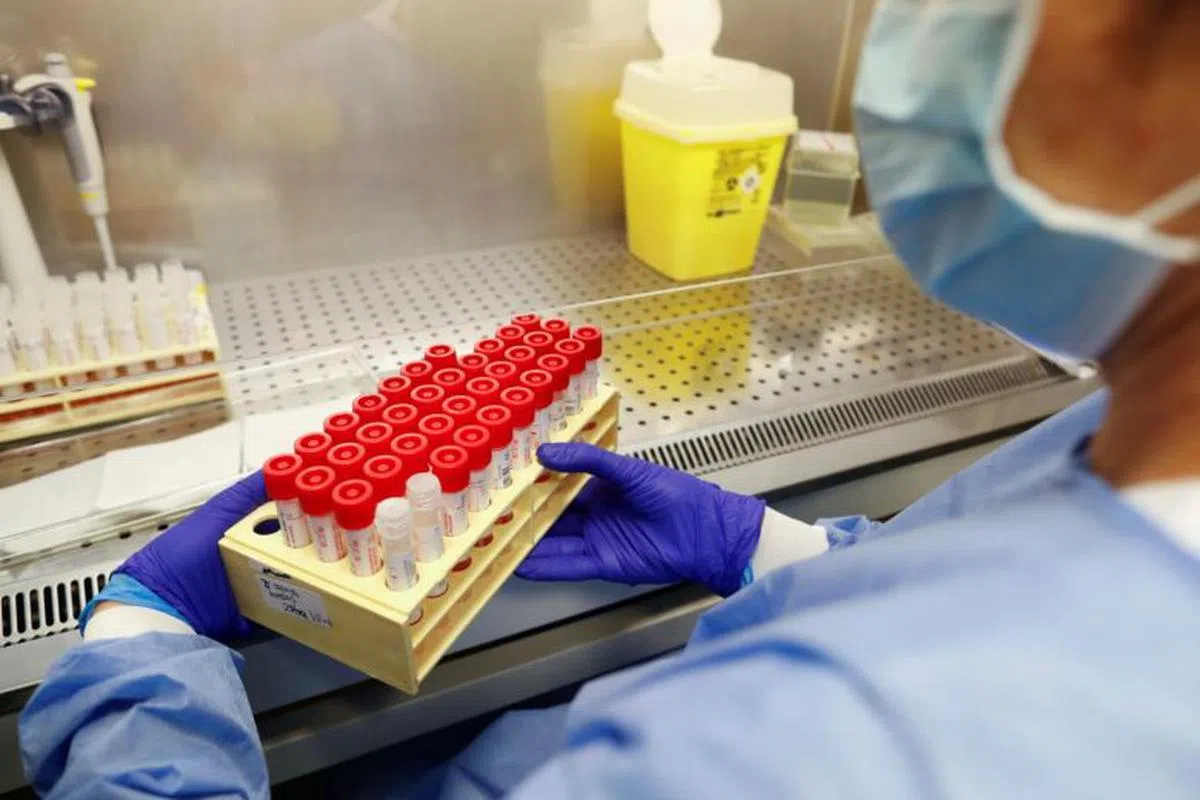  冠病病毒检测。（路透社） 