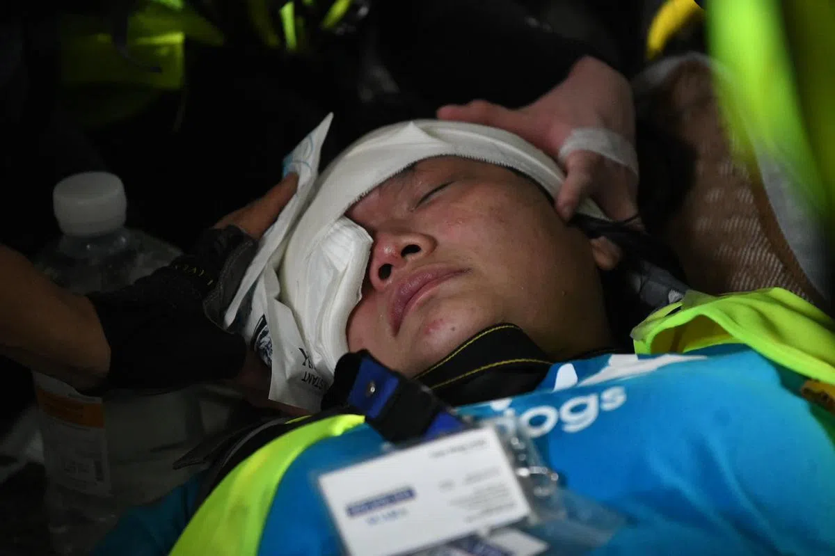  印尼女记者疑似被警方布袋弹击伤右眼。（星岛日报） 