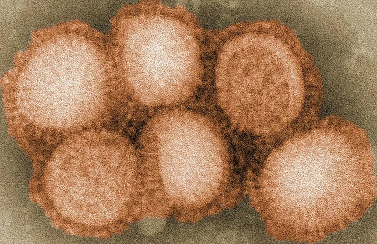 H2N2是不是长得很像……红毛丹？（美国疾病控制与预防中心）