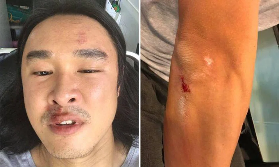 Photos: Julian Hee/ Facebook