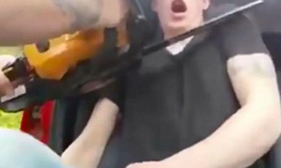 Prank gone wrong: 18-year-old nearly has his hand chopped off after friends woke him up with chainsaw