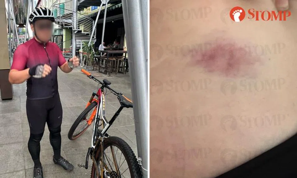 Woman injured after getting knocked down by cyclist, who accuses her of damaging $200 helmet