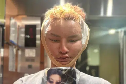 Earthquake tremors don't deter S'porean influencer from completing facelift in bangkok