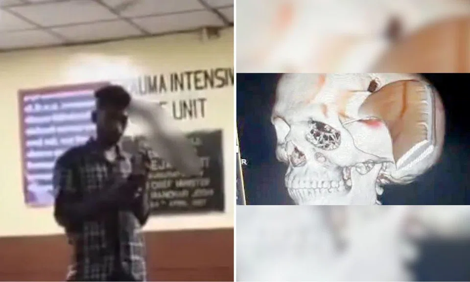 man in india walks into hospital with sickle stuck to his head 