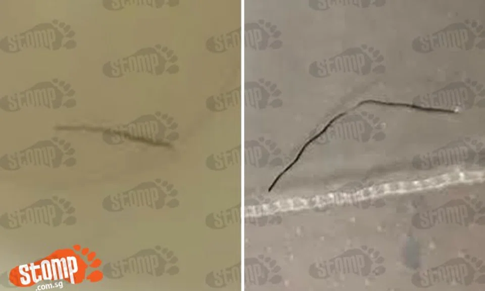 Man vomits blood after metal gets stuck at his throat while eating at Chinatown Point